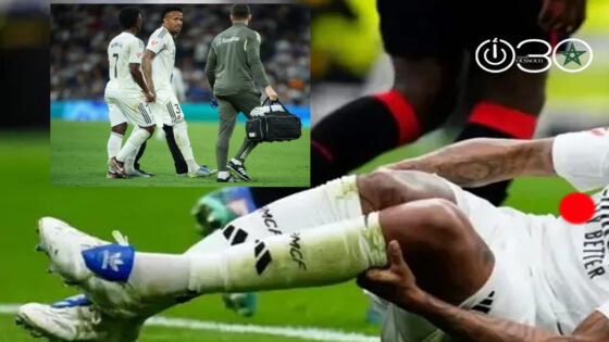 ميليتاو مهدد بالغياب عن البرازيل في المونديال بسبب الإصابة