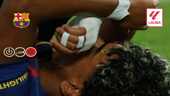 برشلونة يعلن نهاية موسم يامال..وإسبانيا تترقب جاهزيته لكأس العالم